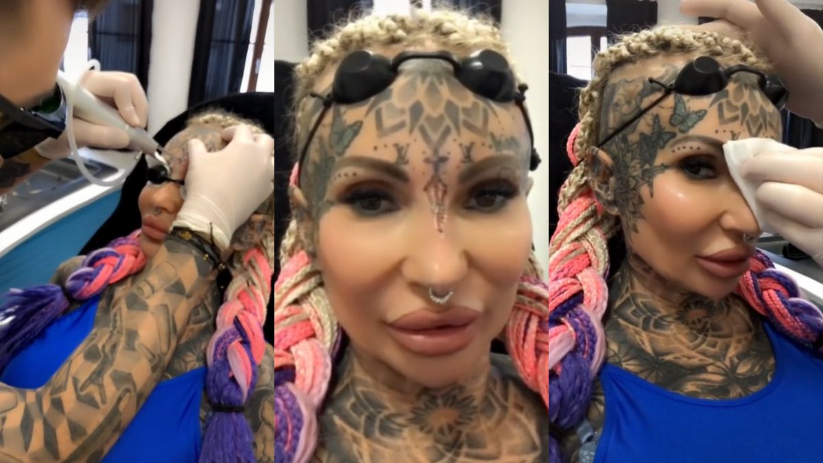 Adrianna Eisenbach z "Królowych życia" relacjonuje usuwanie tatuażu 