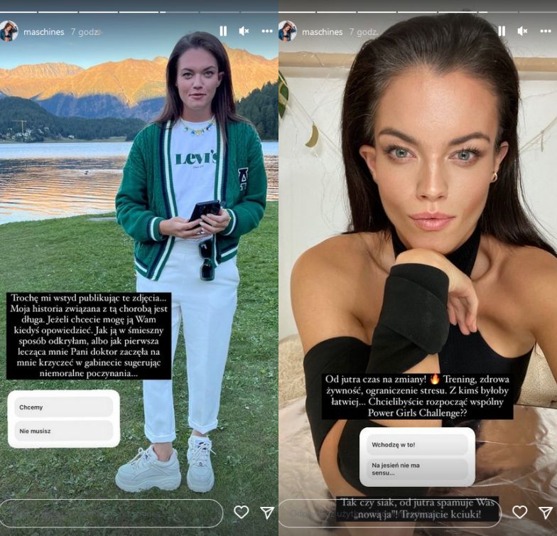 Agnieszka Skrzeczkowska otwiera się w temacie Hashimoto