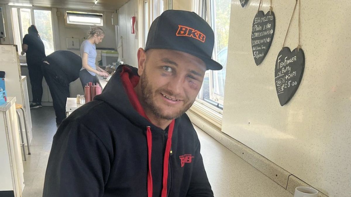 Nathan Decastro mocno ucierpiał podczas ostatniej walki