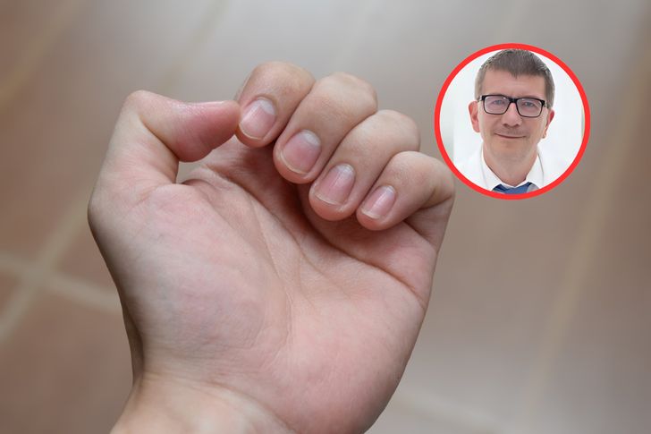 Tam może ukrywać się czerniak. Onkolog wskazuje, gdzie warto zajrzeć
