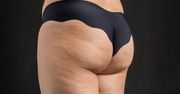 Ćwiczenia na pośladki, które dają szybkie efekty