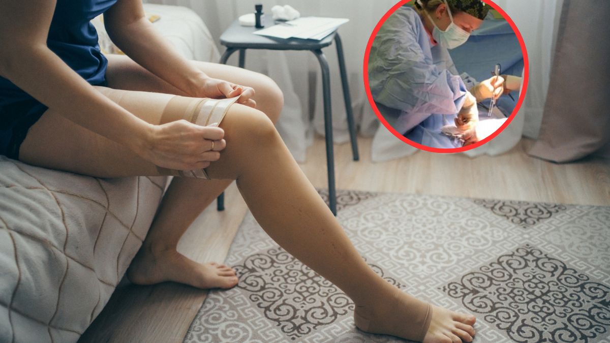 Lekarze wyjaśniają, co może stać za opuchlizną nóg