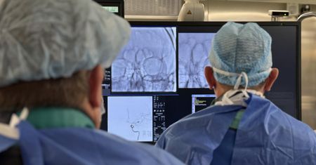 Więcej operacji i szybsza pomoc. Przełom w leczeniu udarów mózgu na Mazowszu