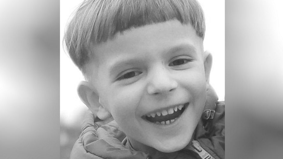 Mieli usunąć dziecku zęby. Chłopczyk zmarł