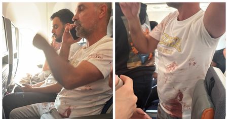 Bójka pilotów na pokładzie. Jest krew. Do sieci trafiły zdjęcia