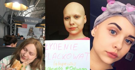 15-latka z Białegostoku oswaja łysienie. Pomaga nastolatkom walczyć z kompleksami (ZDJĘCIA)
