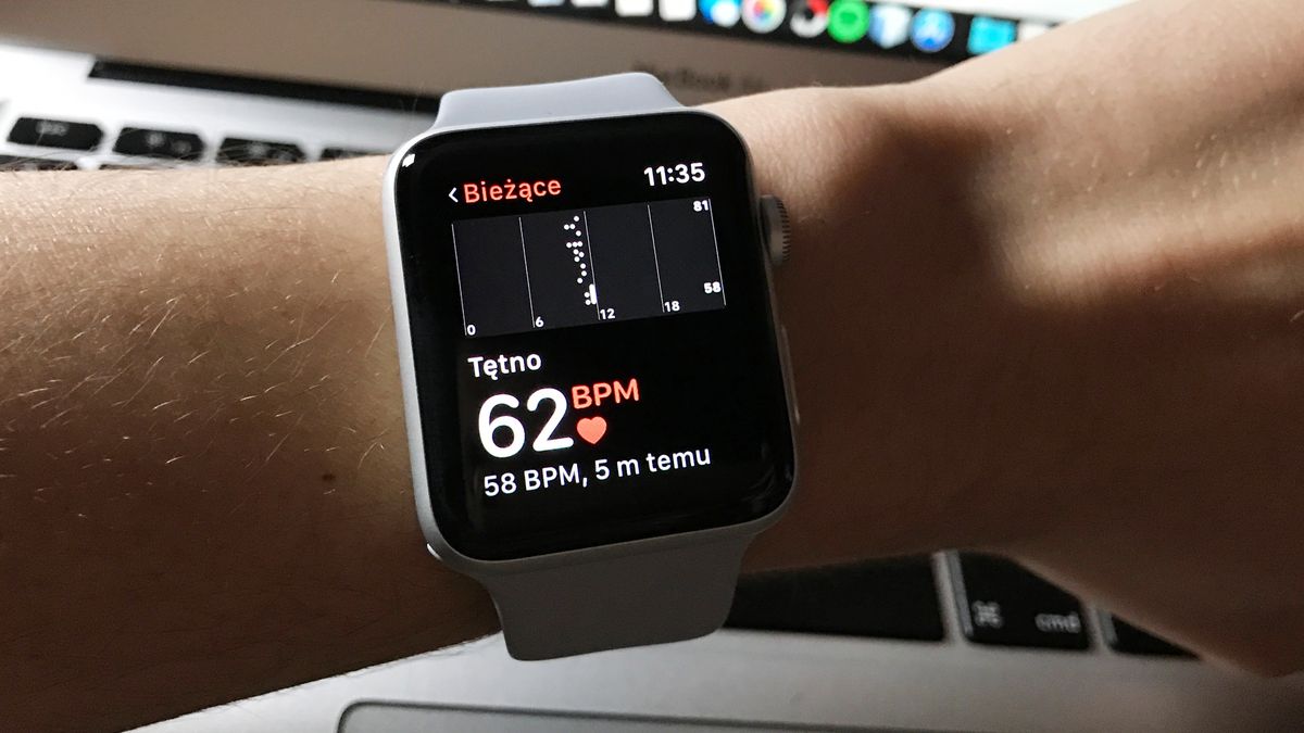 Apple Watch Series 3.