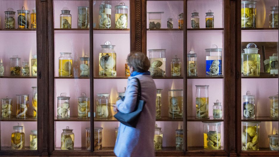 W przeszklonych gablotach znajdują się tysiące eksponatów, od narzędzi chirurgicznych po pływające w formalinie płody
