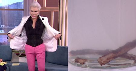 Żywy Ken wyciął sobie żebra i... przyniósł je ze SOBĄ W SŁOIKU DO TELEWIZJI ŚNIADANIOWEJ...