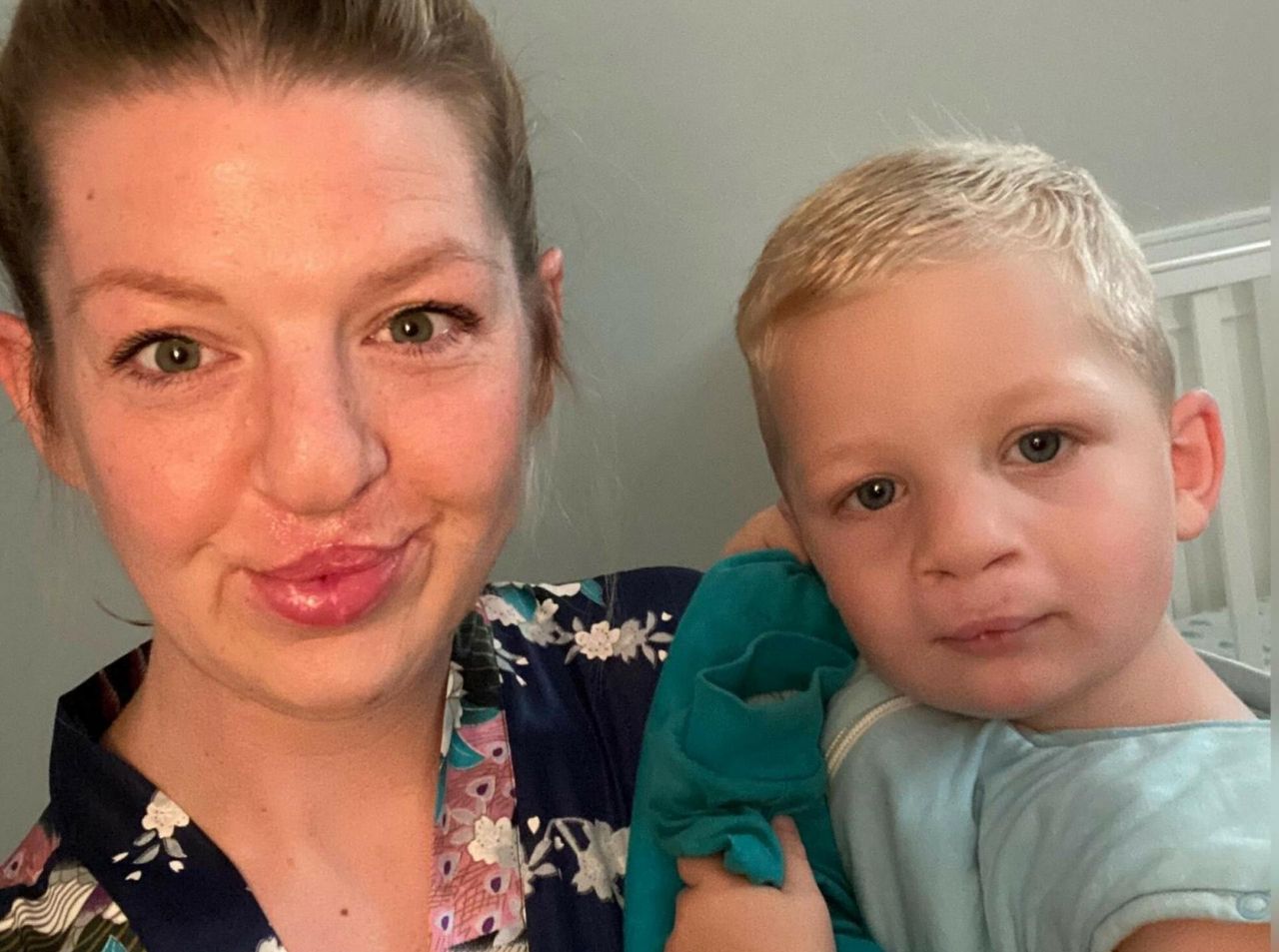 Jej syn urodził się z zajęczą wargą. Matka uważa, że odziedziczył to po niej