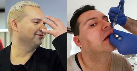 Witkowski: "Liftinguje się wszystko! Całe to mięso spada w dół"