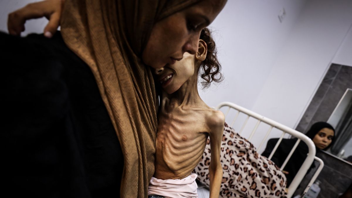 9-letnie dziecko z Gazy cierpi na zagrażające życiu niedożywieni