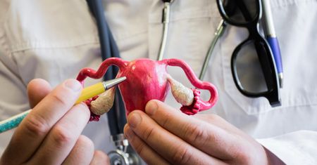 Endometrioza po cesarskim cięciu