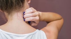 Swędzenie szyi - o jakich chorobach może świadczyć? Sprawdź ryzyko