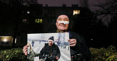 Marsz Niepodległości. Postrzelony fotoreporter żąda odszkodowania. Podał kwotę