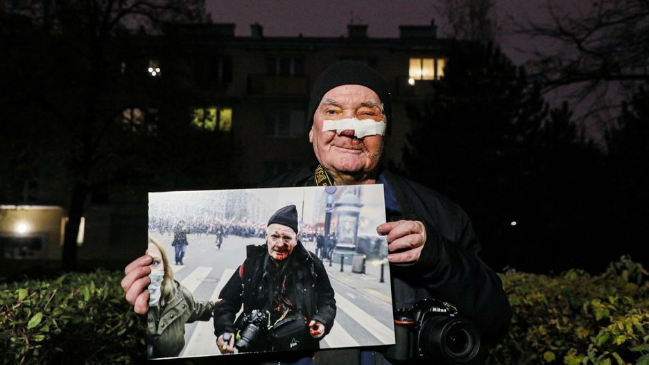 Marsz Niepodległości. Postrzelony fotoreporter żąda odszkodowania. Podał kwotę