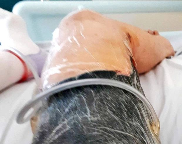 Zainfekowana noga Jodie