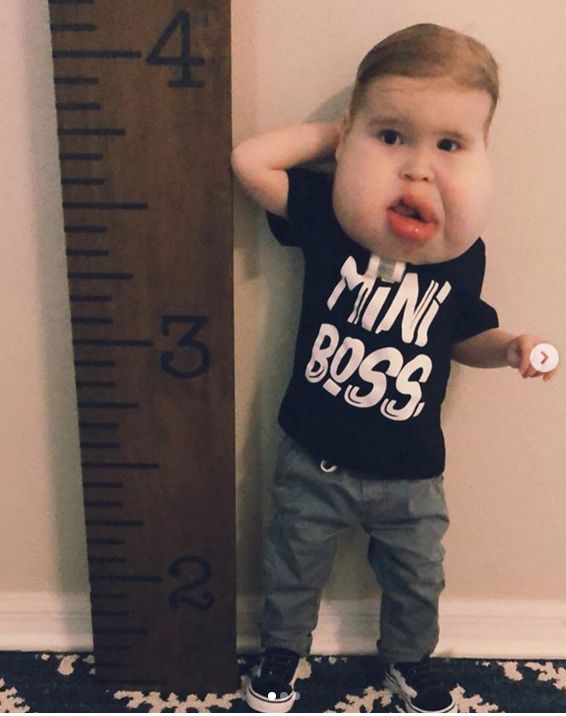 Gavin rośnie tak samo jak jego równieśnicy (Intsagram/gavinsmedicaladventure)