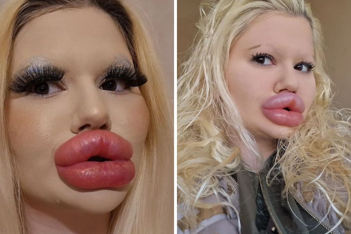 Andrea Ivanova jest posiadaczką &quot;największych ust na świecie&quot;