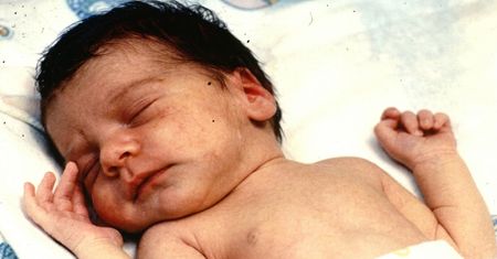 12-dniowemu dziecku wszczepili serce pawiana. Historia, która porusza