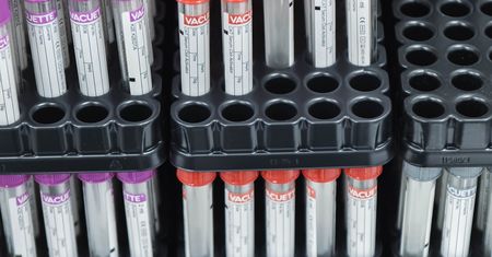 Japońska księżniczka Yoko zachorowała na koronawirusa