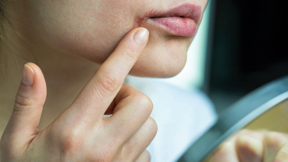 Pięć maści z apteki, które kosztują niewiele, a potrafią zdziałać cuda