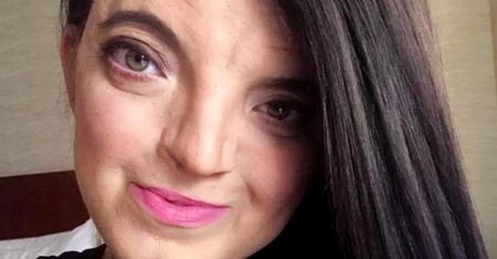 Urodziła się ze zdeformowaną twarzą i czaszką. Rena Rosen uczy dziś o tolerancji