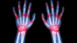 Choroby, które nasilają się zimą (WIDEO)