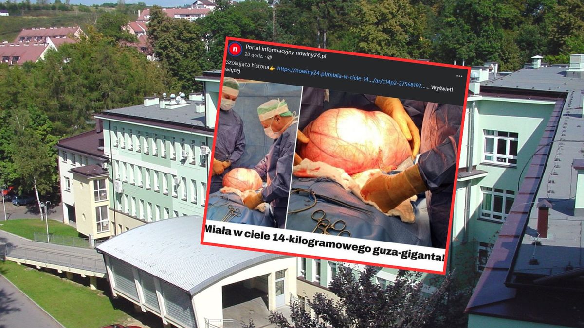 Kobiecie wycięto guza o masie 14 kg