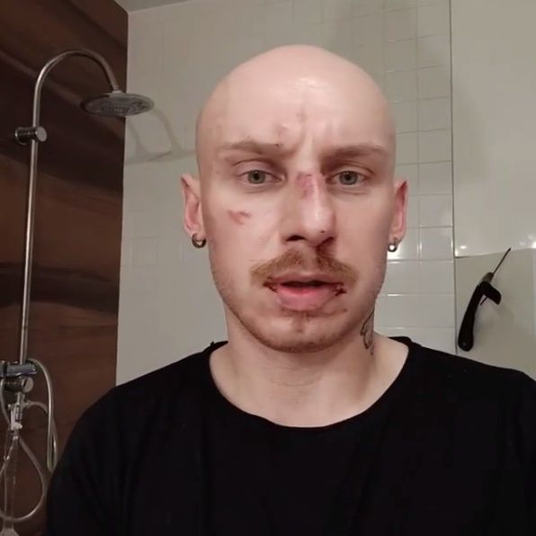 Jacek Szawiola z "Gogglebox" został pobity