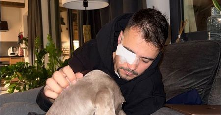 Rezigiusz miał wypadek z psem. Jego oko mocno ucierpiało