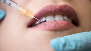 Powikłania po wypełniaczach. Jak ultrasonografia może im zapobiec?