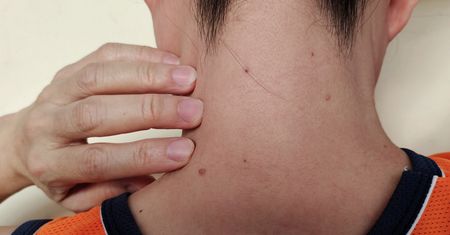 Pojawiają się nagle i zwykle nie bolą. Mogą zwiastować zaburzenia metaboliczne