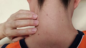 Pojawiają się nagle i zwykle nie bolą. Mogą zwiastować zaburzenia metaboliczne