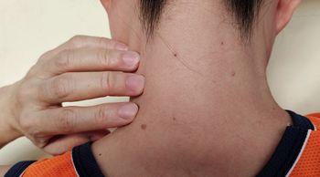 Pojawiają się nagle i zwykle nie bolą. Mogą zwiastować zaburzenia metaboliczne