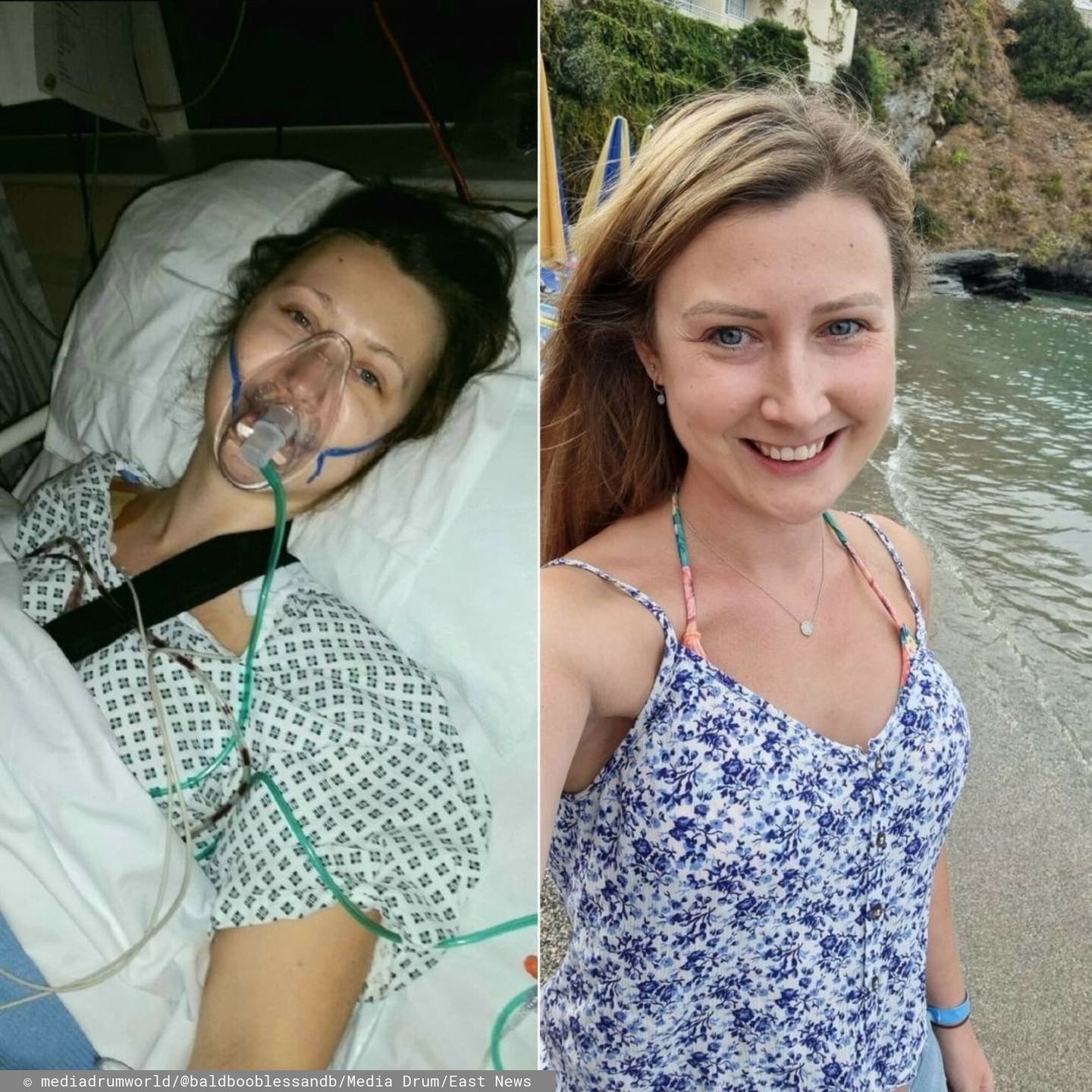Laura choruje na nieuleczalnego raka piersi