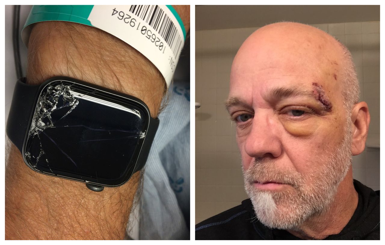 Apple Watch uratował go przed śmiercią. Smartwatch wykrył upadek i wezwał pomoc