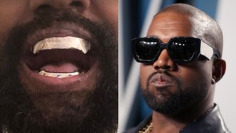 Kanye West prezentuje TYTANOWY UŚMIECH za ponad 3 MILIONY złotych. Gustownie? (FOTO)