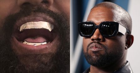 Kanye West prezentuje TYTANOWY UŚMIECH za ponad 3 MILIONY złotych. Gustownie? (FOTO)