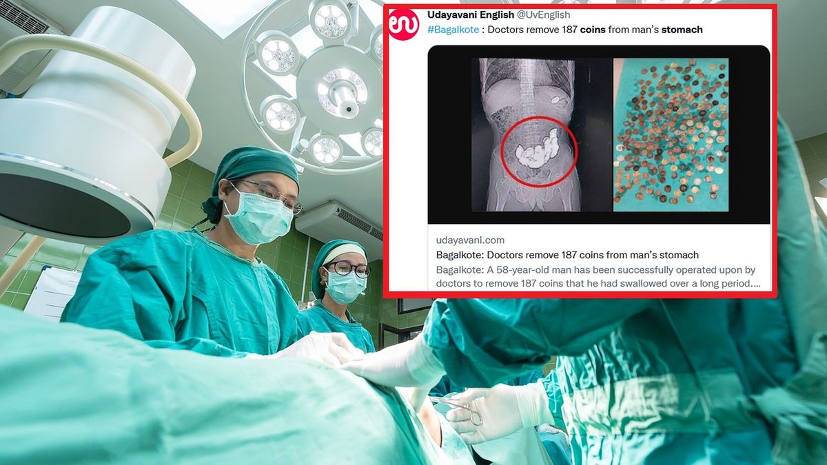 Lekarze odkryli 187 monet w żołądku mężczyzny po tym, jak skarżył się, że jest "wzdęty"