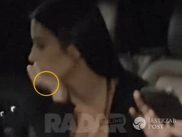 Nagrania z hotelu L’Hôtel de Pourtalès w dniu napadu na Kim Kardashian