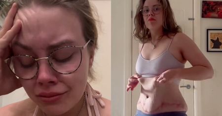 26-letnia Brytyjka poleciała na operację plastyczną do Turcji. Twierdzi, że ją OSZPECILI!