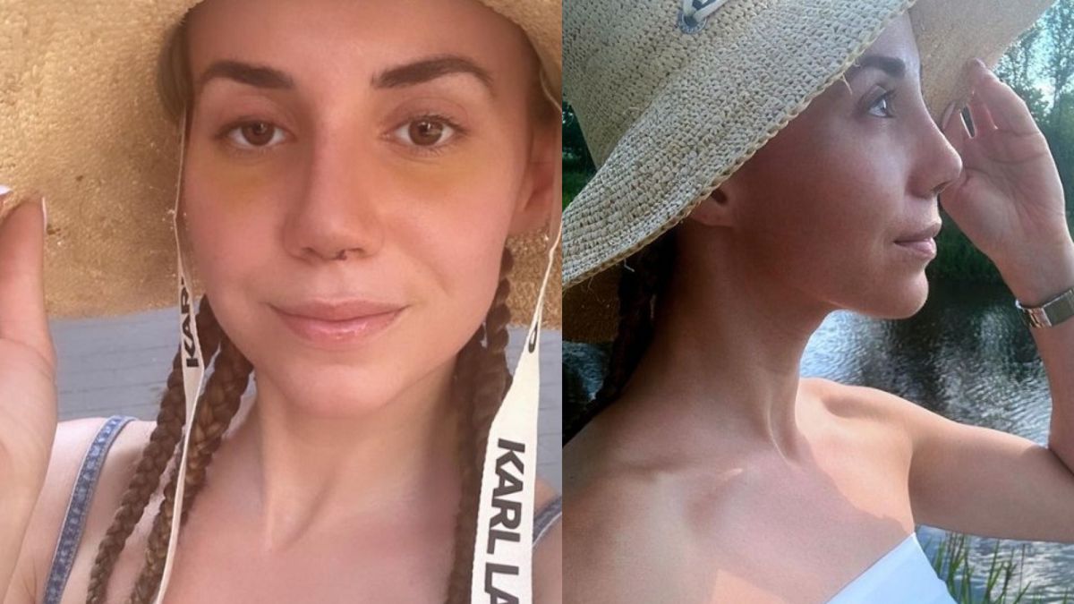 Marianna Schreiber mówi o nowym nosie. 