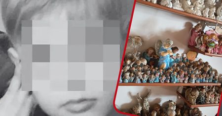 Nie żyje Kamilek. Lekarze pokazali, co zostało po chłopczyku. Zdjęcie porusza