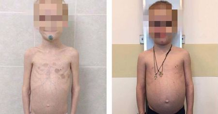 Latami głodziła synka. W ten sposób wyłudzała zasiłek