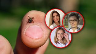 Nowy rodzaj kleszczy w Polsce. "Szybko biegają i potrafią 'gonić' ofiarę"