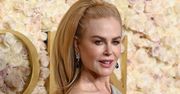 Fani są zaniepokojeni. Widzą u Nicole Kidman "uszy nietoperza"