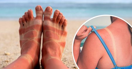 Kiedy zasnęłam na plaży, słońce spiekło mnie na czerwono. Uratował mnie stary patent babci