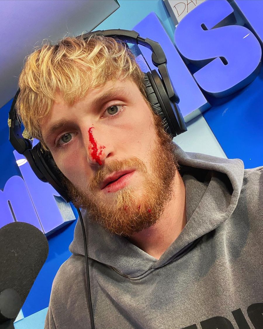 Logan Paul