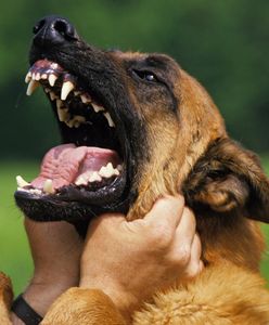 Pies pogryzł 83-latka. Wcześniej nie zachowywał się agresywnie